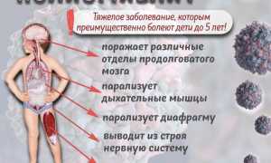 Полиомиелит