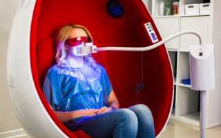 Экспресс отбеливание зубов White Smile: особенности методики
