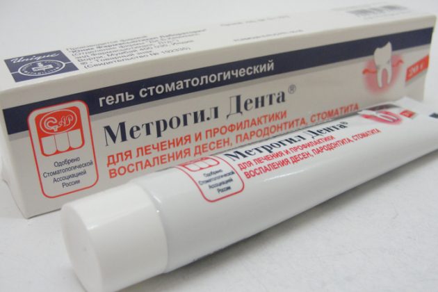 Метрогил Дента применяется для облегчения состояния, когда опухла десна под коронкой